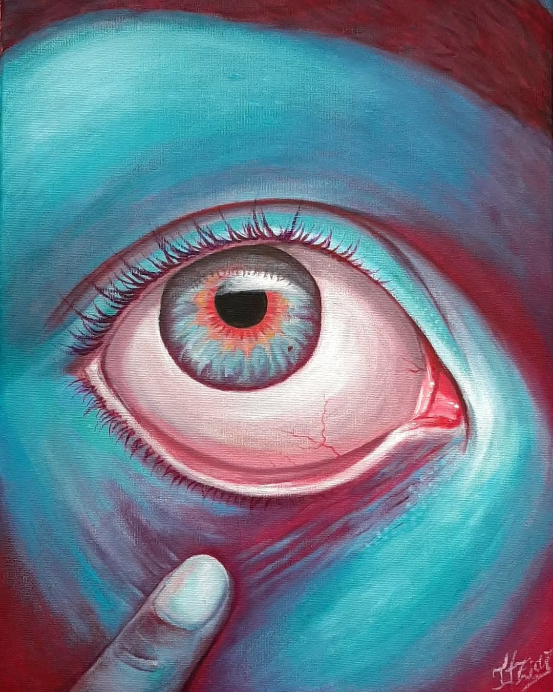 Ojo I